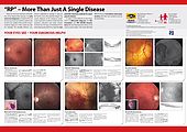 poster differential diagnostics